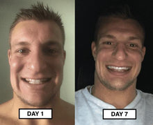 Load image into Gallery viewer, Snow® At-Home Teeth Whitening Kit (JAWZRSIZE special)

